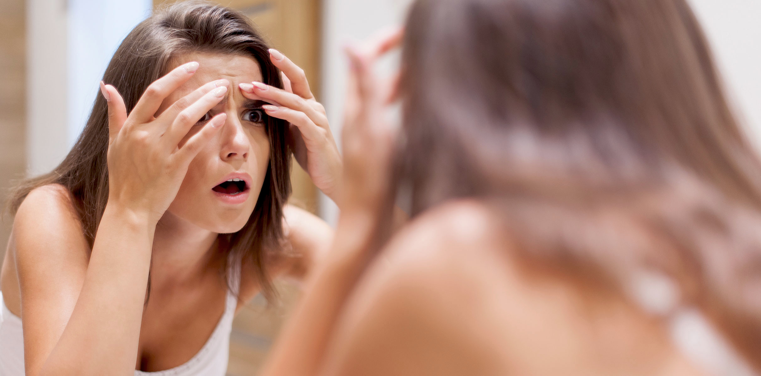 Emotional Stress And Acne!! Is It True That Worrying Causes Acne?